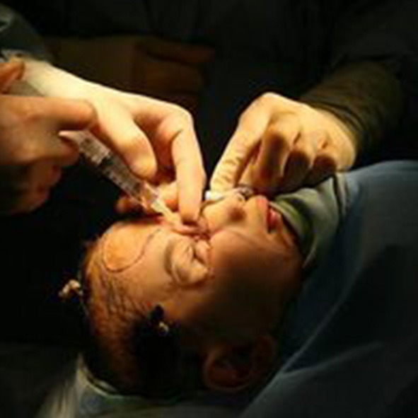 Image: Photo from The Seattle Times of Humoody Smith during an operation to repair damage to his face. A surgeon injects fluid into the bridge area of rebuilt nose tissue.